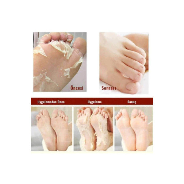 Mjcare Miracle Foot Peeling Pack - Mjcare Sock Type Foot Peeling Mask